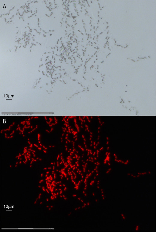 (from research article) Autofluorescent Gloeobacter kilaueensis JS1T cells observed under bright field (A) and fluorescent microscopy (B). Both fields recorded through a 63× objective with oil immersion on a Zeiss PALM Laser Capture Microdissection MicroBeam IV system. Dividing cells are visible. Scale bar = 10 µm.